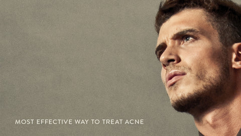 Most Effective Way to Treat Male Acne