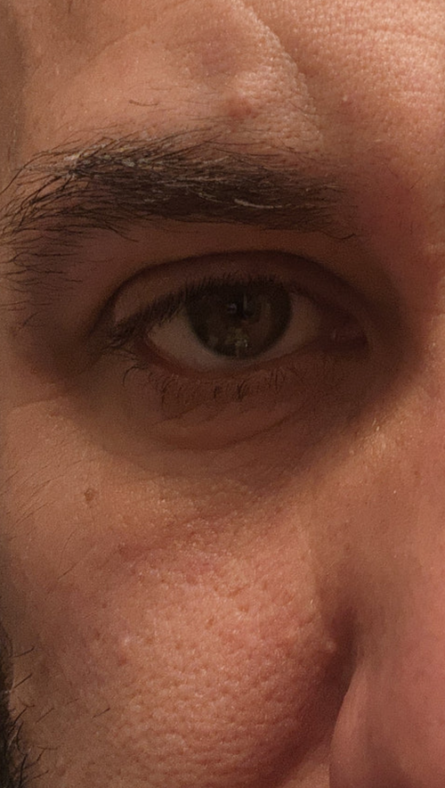 “Skin looks tighter - feels softer and not as puffy."