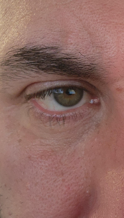“Skin looks tighter - feels softer and not as puffy."