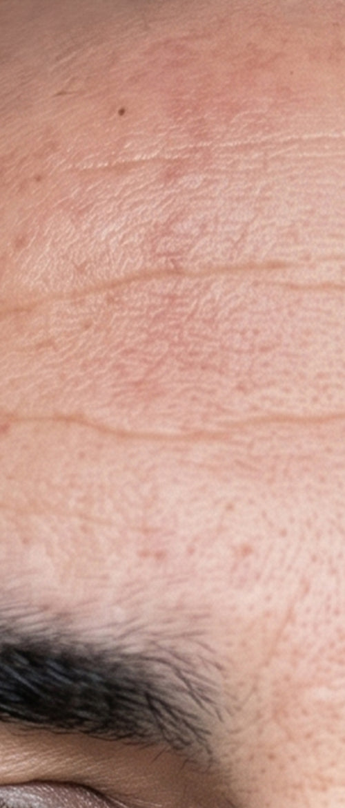 "The best way i can describe it is that to me my skin looks healthier."