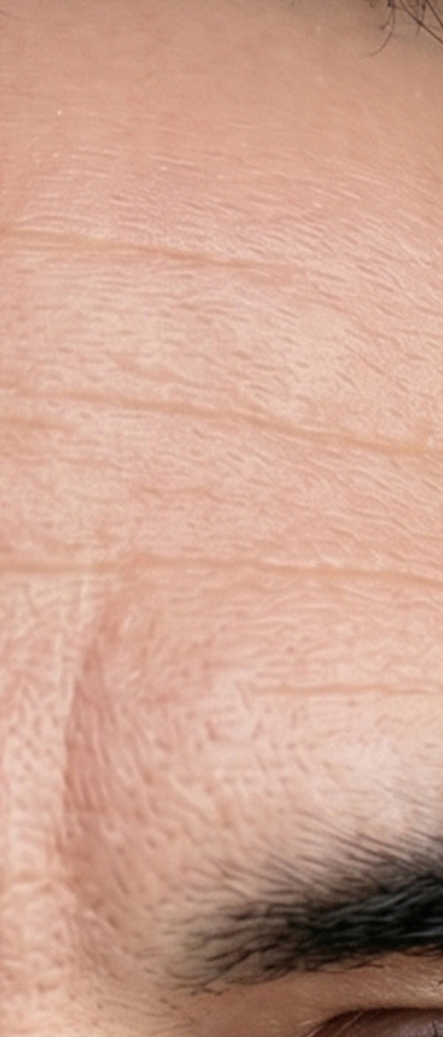 "The best way i can describe it is that to me my skin looks healthier."